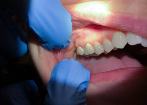 Best Emergency Cosmetic Dentistry (e.g., broken veneers) in Derby, KS